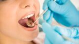 Tratamento de Endodontia (Canal)